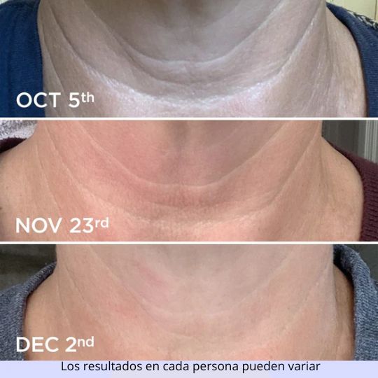 CREMA REAFIRMANTE PARA EL CUELLO