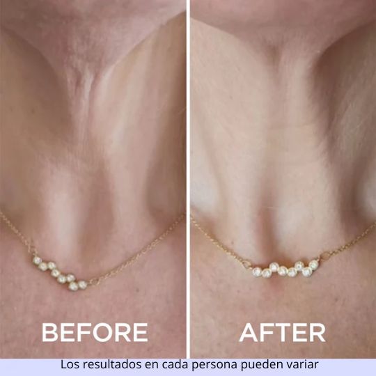 CREMA REAFIRMANTE PARA EL CUELLO