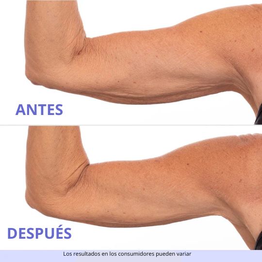 CREMA PARA ESCULPIR Y TONIFICAR BRAZOS - GOPURE