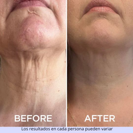 CREMA REAFIRMANTE PARA EL CUELLO